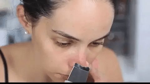 Ultrasonic Scrubber Blackhead Remover