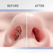 2-in-1 Unisex Nose & Eyebrow Trimmer
