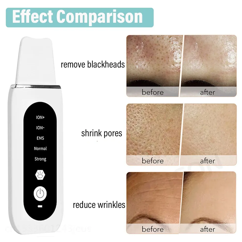 Ultrasonic Scrubber Blackhead Remover